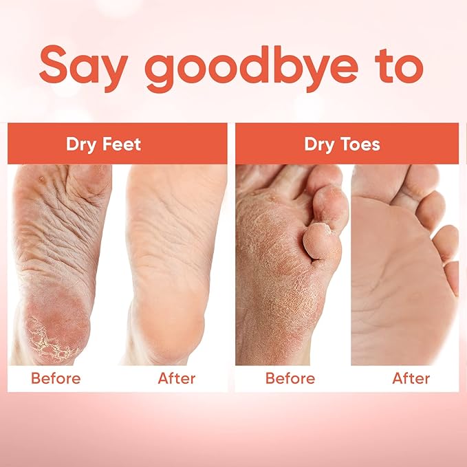 Foot Peel Mask - Foot Mask for Baby Soft Skin - Remove Dead Skin, Dry, Cracked Feet & Callus, Foot Spa, Made with Aloe Vera Extract for Women and Men (2 Pairs Peach)