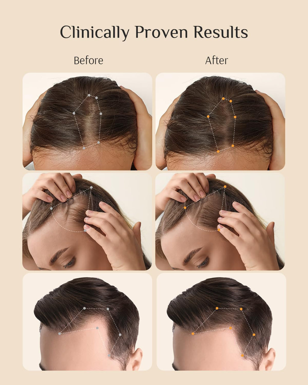 DR ZERO Men's Hair Growth Serum, Japanese Hair Care, Volumizing High-Performance Hair Thickening, with 3% Redensyl® & Nano-Tech Improves Thinning, Sulfate & Silicone-Free, No Side Effects, 2 oz