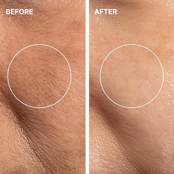 THOME G-Peel Program (6 Sheets) | 4-Step Gentle Peeling for All Skin Types, Sensitive & Dry Skin | Perfect Routine to address fine wrinkles, lines, and hyperpigmentation