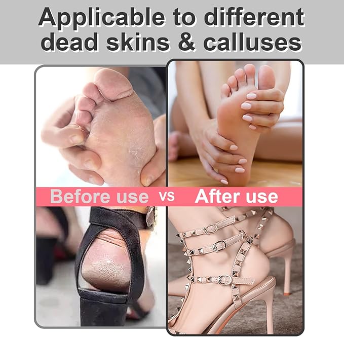 Electric Foot File - Callus Remover for Feet,Adjustable Speed Foot Scrubber with 60 Pcs Sandpaper Discs,Professional Pedicure Tool for Dead Skin and Calluses - Matte Black