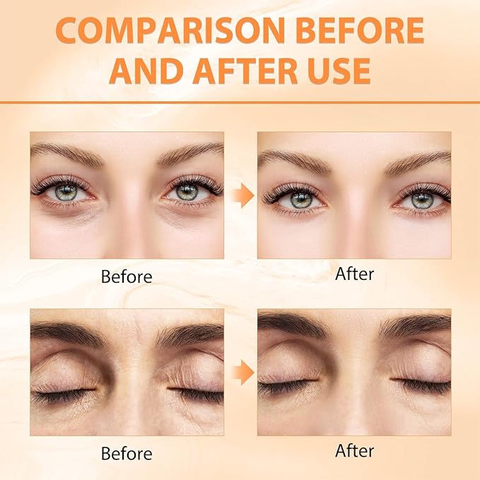 2PCS Revive Glow Vitamin C Eye Balm, Reducing Dark Circle,Hydrating Eye Cream,Improve Dark Circles,Reduces Puffiness (2pcs)