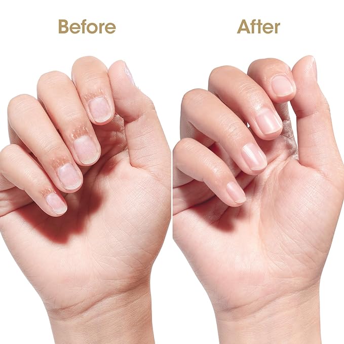 Gellen Nail Oil For Growth and Strength, Vitamin E Nail Cuticle Oil Moisturizer Strengthener Skin Cuticle Nail Care Nourishing Oil for Hydrating, Moisturizing, Strengthening, Repairing, 0.68 Oz