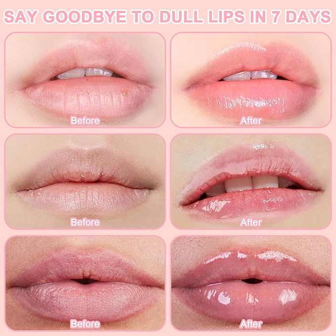 4 PCS Bee Lip Balm Honey Pot, Hydrating Lip Mask & Lip Scrub Set, Watermelon Strawberry Apple Lime Peach Moisturizing Lip Sleeping Mask Prevention Dry and Cracked, Reduce Lip Lines