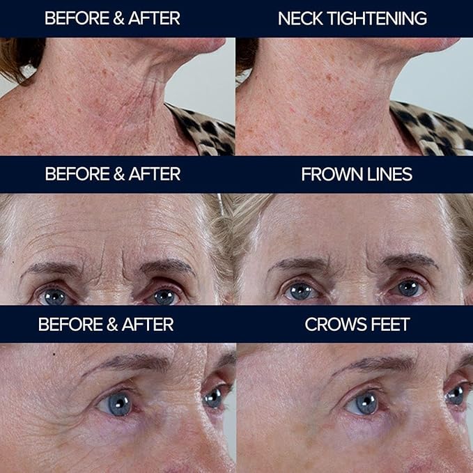 Peptide10 by Adonia Organics - Instant Wrinkle Concealer - Peptide 10 Instant Anti-Aging Serum