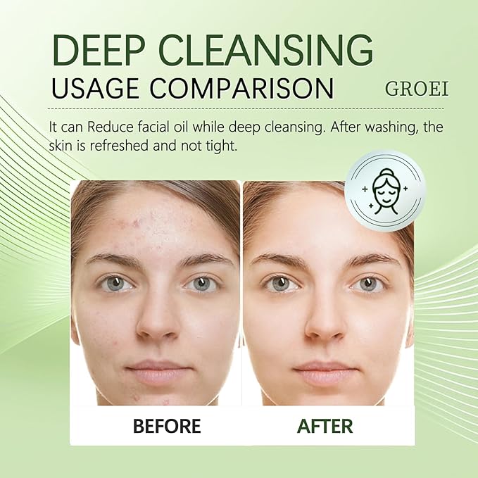 Face Wash, Oil Face Wash Oil for Face Skin Irritation And Prevents Breakouts (2)