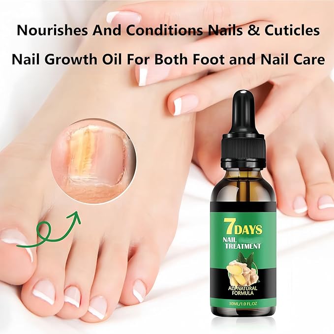 2Pcs Ginger Nail Growth and Strengthener-Nail Growth Serum-30ML Each Natural Nail Strengthener for Damaged Nails-Ginger Nail Treatment