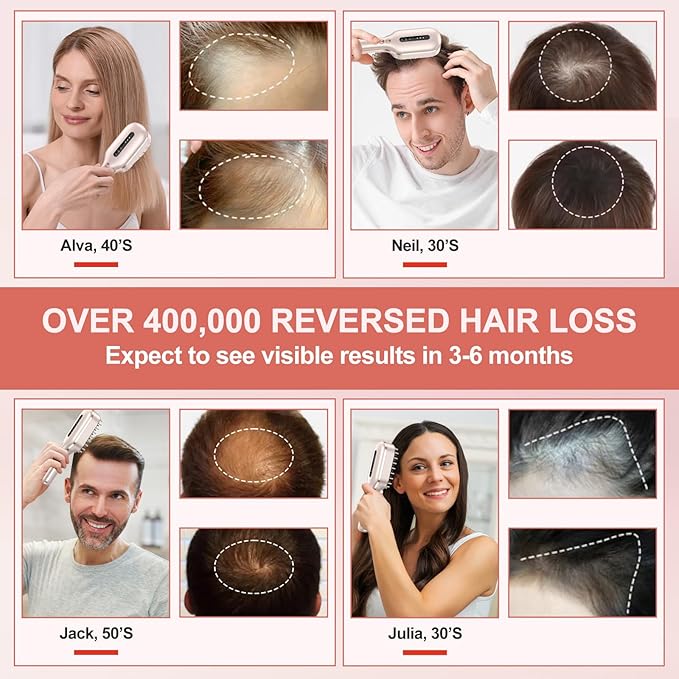 Laser Therapy Hair Growth Comb,FDA Cleared laser comb for hair growth,Red Light Electric Scalp Massager (Pink)