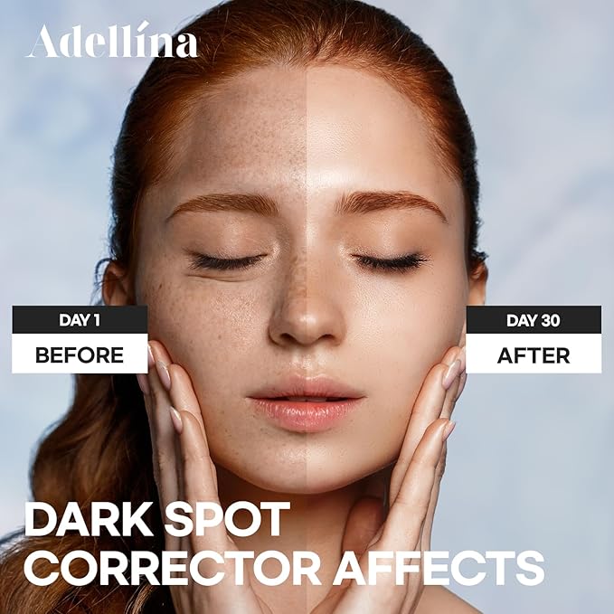 Dark Spot Remover for Face Serum: Dark Spot Corrector for Age Spot Sun Spot and Freckles Melasma - Advanced Formula with Niacinamide for Skin Care 1oz