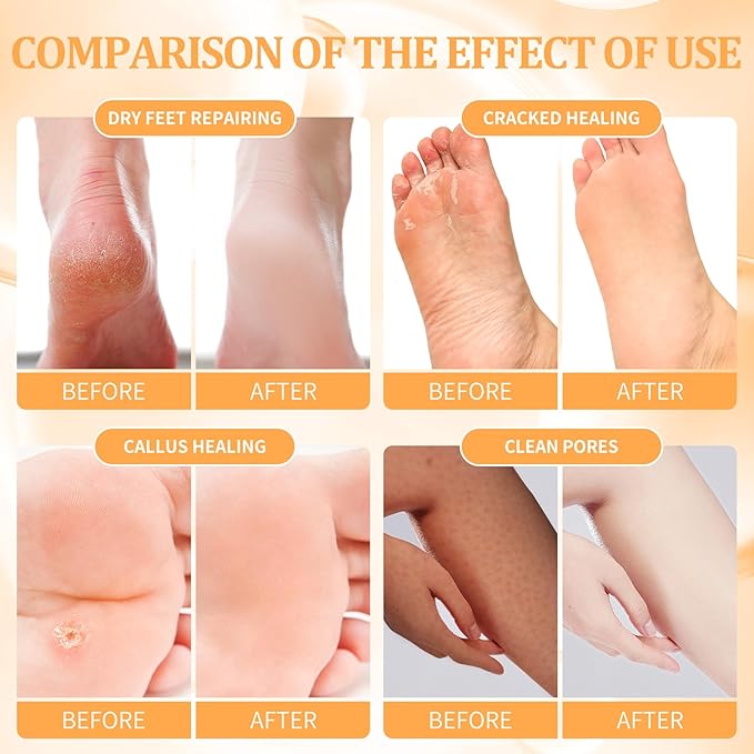 Pedicure Kit Foot Soak Set: Bubble Salt, Sugar Scrub, Massage Mask, Massage Lotion in a Box, 4 Step Foot Spa Kit for Dry Feet, Softens Calluses and Tired Feet（1 Set Orange)