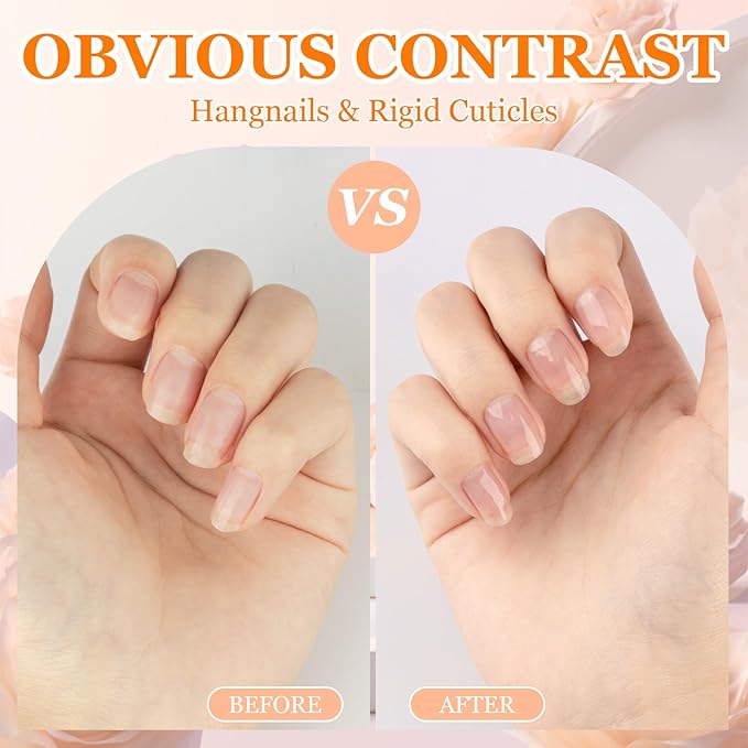 Meschett 4PCS Cuticle Oil Pens with Nail File for Nail Care, Nail Pen Oil with Natural Ingredients, Fingernails and Toenails Oil Cuticle for Repairing Cracked(Mix Flavors)