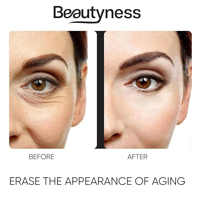 Instant Ageless Eye Cream – Anti Wrinkle Cream, Removes Under Eye Puffiness, Bags, Expression Lines, & Dark Circles. Powerfully Tighen & Lifts Sagging Skin. Disappears Before Your Eyes In Minutes.
