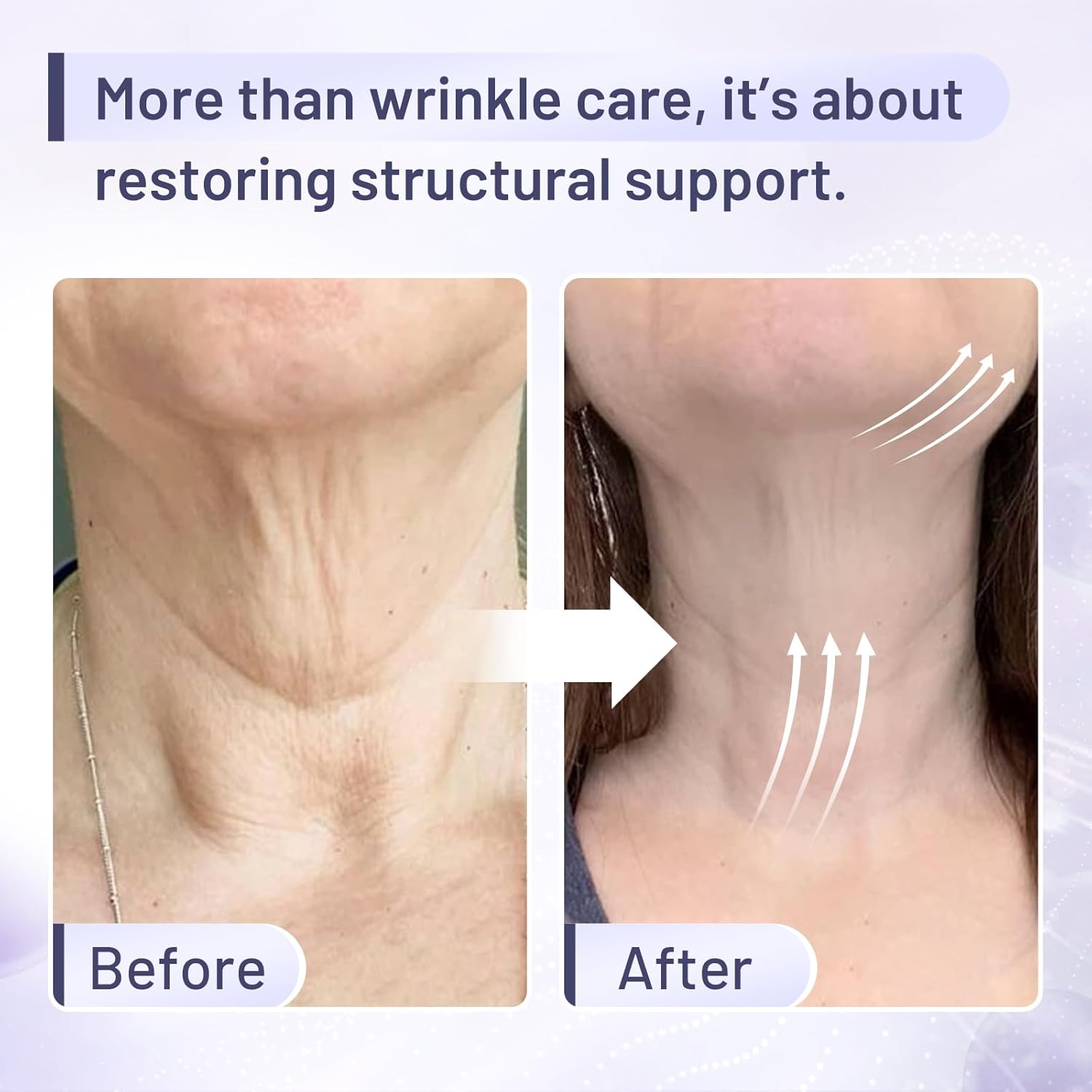 Premium Neck Firming Cream – Lifting & Tightening Treatment for Décolleté and Chest, Reduces Fine Lines and Sagging, Gift for Women & Men, 2.03 Fl Oz