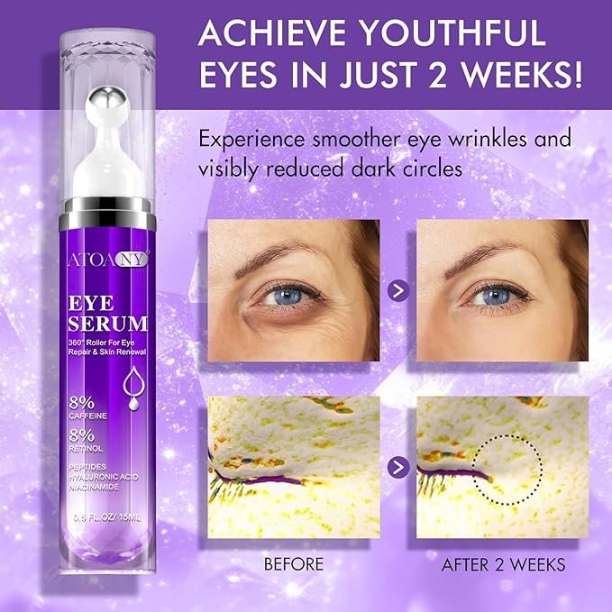 Eye Serum for Dark Circles and Puffiness with 8% Caffeine 8% Retinol Hyaluronic Acid Niacinamide, Under Eye Cream Anti Aging for Puffiness and Bags with 360° Eye Roller Ball for Women
