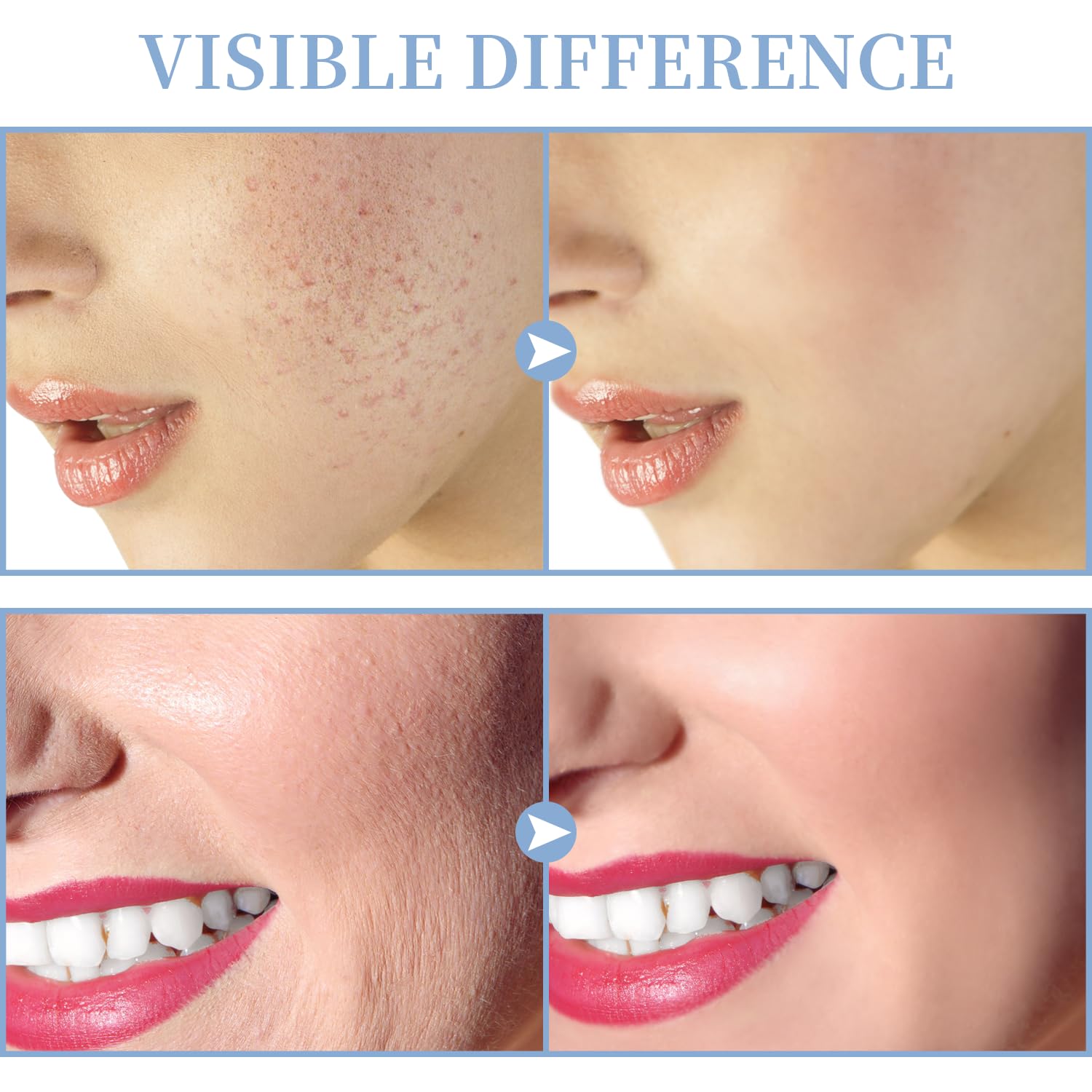 High Frequency Facial Machine - TUMAKOU Portable Handheld High Frequency Facial Skin Wand Machine with 4 Different Tubes