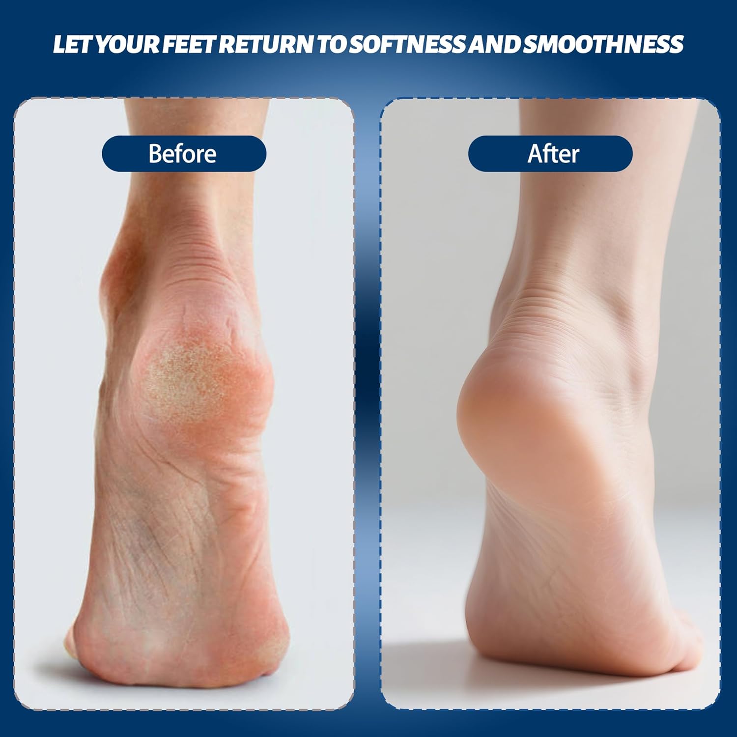 Electric Feet Foot Callus Remover Equipped with A Vacuum System Foot Scrubber 17 in 1 Professional Foot Care Tool Ipx6 Waterproof Rating for Removing Hard Cracks Dryness and Dead Skin (Black)