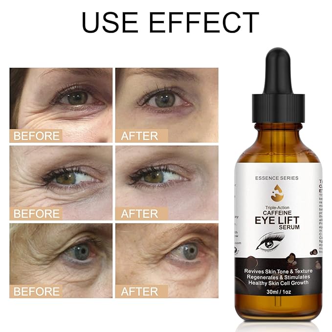 Caffeine Eye Serum - with EGCG, Vitamin C, Hyaluronic Acid, Collagen, Caffeine Eye Lift Serum - Reduces Puffiness, Dark Circles, Under Eye Bags, Wrinkles and Fine Lines Around The Eyes (30ml)