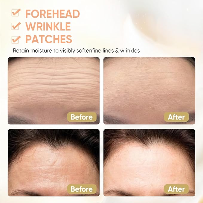 12Pcs Forehead Wrinkle Patches for Women, Hydrolyzed | Collagen | Vitamin E | Aloe Vera to Reduce Wrinkles Forehead Wrinkles Treatment Overnight (White)