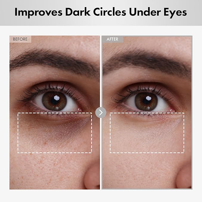 Hyaluron Lifting Eye Cream, Hyaluronic Acid, 5% arbutin, Niacinamide for Puffy Eyes, Dark Spot and Fine Lines, Hydrating Under Eye Bag, Korean Skin Care, 15ml, 0.5 fl. oz.