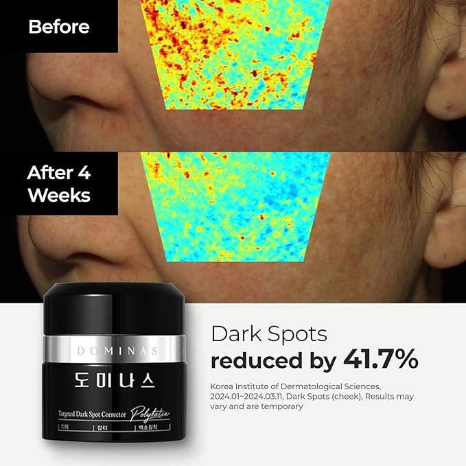 Advanced Korean Cream (1.76oz) + Retinol Serum (1fl oz) Hydration & Firming Skincare Duo with Niacinamide, Peptide, Vitamin C, TECA – Targets Fine Lines, Pigmentation & Elasticity