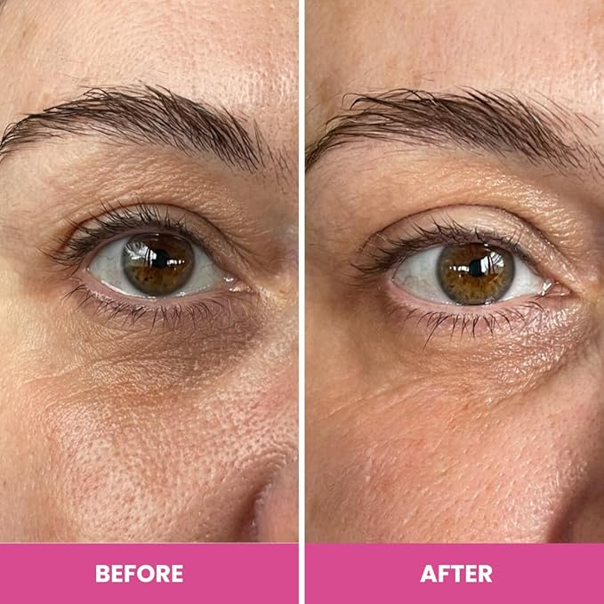 PrimeEyes Hydrate Under Eye Cream for Mature Women – Hydrating Eye Cream for Dark Circles and Wrinkle Repair – Soft, Glowing & Healthy Under Eyes