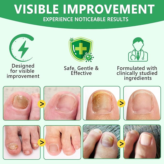 Ginger Nail Serum,Nail Growth Serum, Ginger Cuticle Care Oil for Strengthen Nails & Promote Nail Growth, Natural Plant Formula 2 Fl.oz