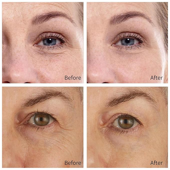 30 Pairs Retinol Collagen Under Eye Patches for Dark Circles Puffiness Wrinkles and Bags, Skin Treatment Pads for Women Gift, Anti Aging Moisturizer Under Eye Masks for All Skin Type