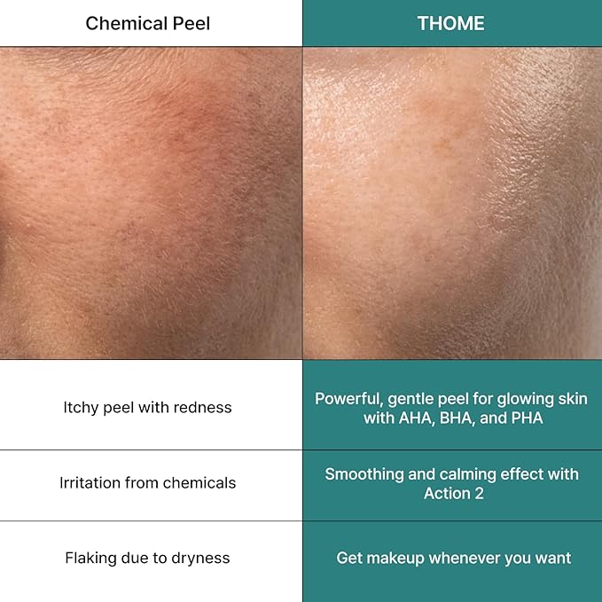 THOME Glow Sealer Mask Refill Set | 6 Sheets of Ultra-high Hydration for Chemical G-Peel at home