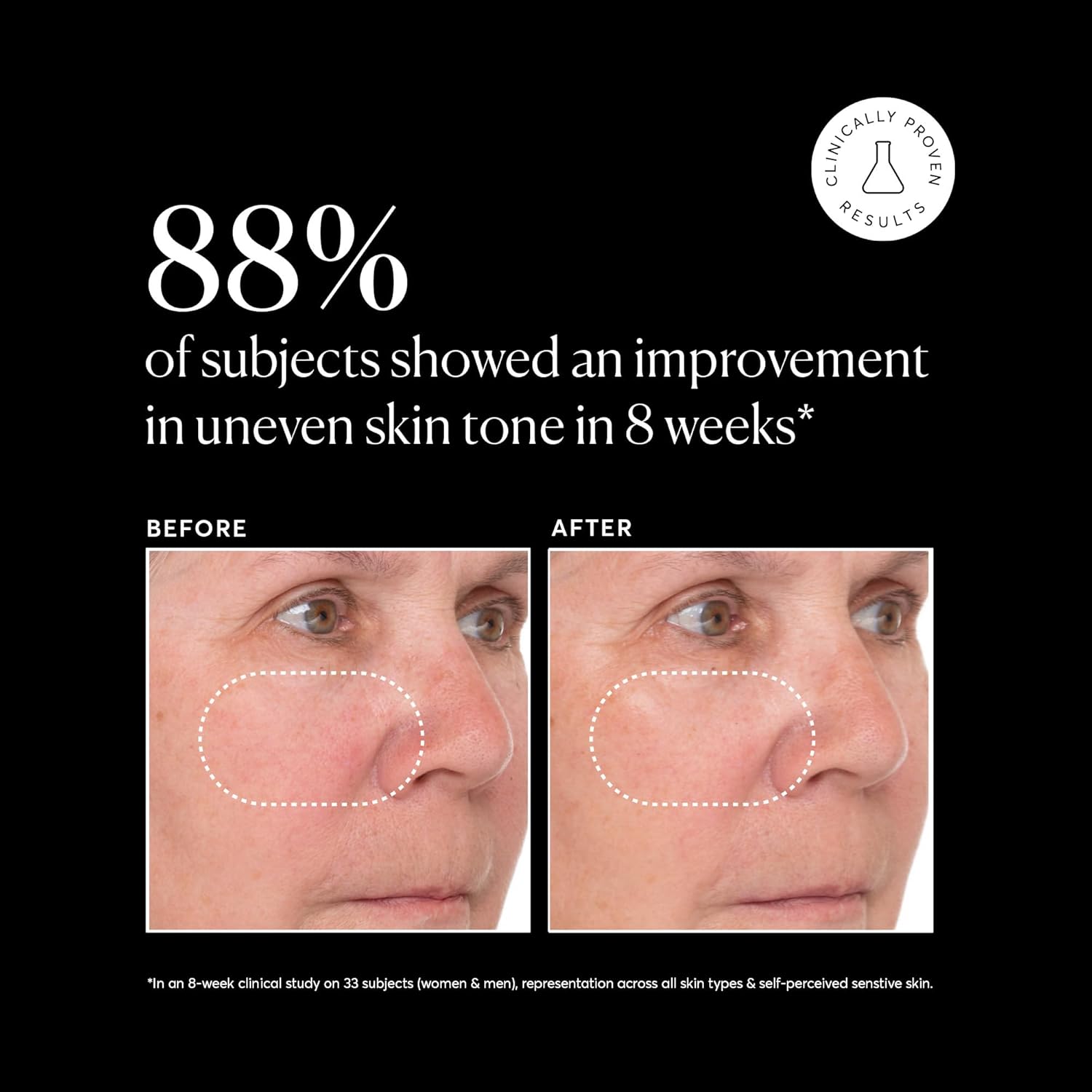 Naturium Vitamin C Super Serum Plus Jumbo, Smoothing Face Care, plus Retinol, Hyaluronic Acid, Niacinamide & Salicylic Acid, 2 oz