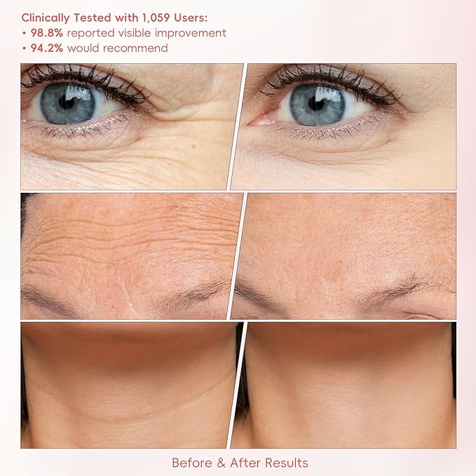 Peunitory Eye Balm, Under Eye Cream Brightener Balm Stick For Wrinkles Dark Circle Treatment Moisturizing Relief Skin Elasticity 0.32oz/9g