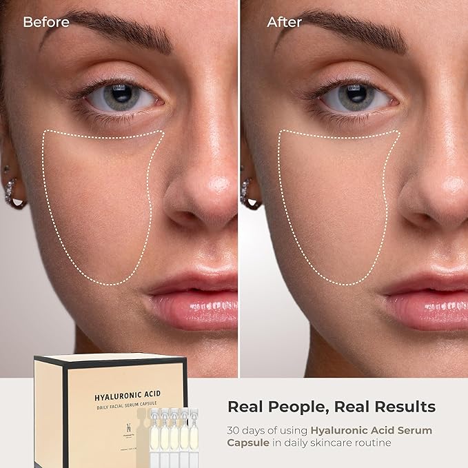 VivienneHu Hyaluronic Acid Serum Capsules, Hydrating Serum for Face with Retinol, Intense Hydration & Skin Plumping, Daily Facial Hydration Serum, Face Plumping Serum - 30 Capsules
