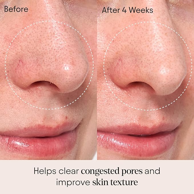 Alpyn Clarifying Facial Oil with Retinol & Pink Algae | Clear Congestion, Smooth Fine Lines, Improve Texture & Glow | 1 Fl Oz / 30 ml