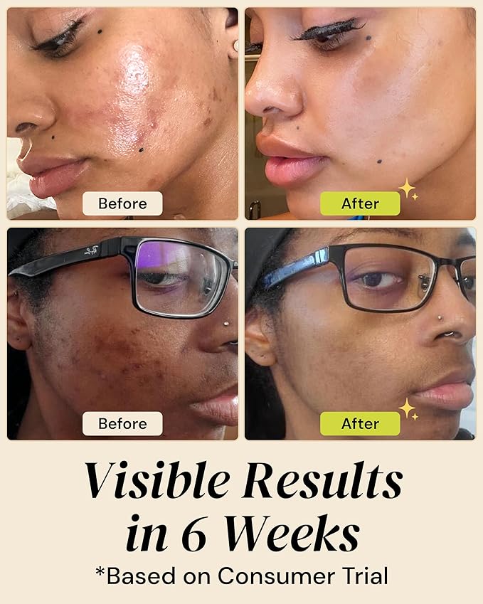 Gleamin Brightening Skincare Bundle – Mask, Serum, Cleanser, Moisturizer & Oil for Dark Spots, Uneven Tone, and Glowing Skin – Complete Vitamin C Skincare Routine