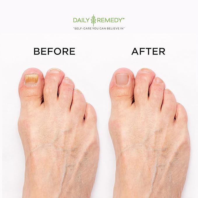 DAILY REMEDY EXTRA STRENGTH Tea Tree Oil Foot Soak w/ Epsom Salt Made in USA Toenails，Athlete's Foot，Itchy Feet，Stubborn Smelly Foot Odor，Pedicure Calluses & Soothes Sore Tired Achy Feet 16 oz，Black