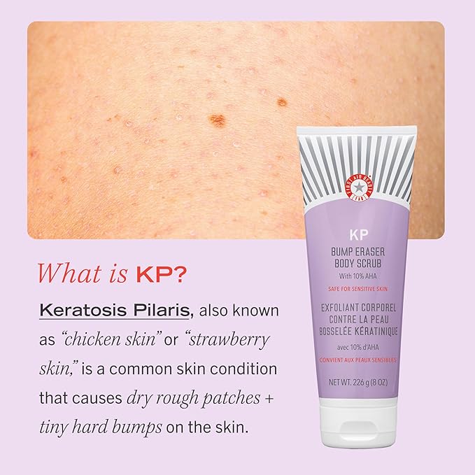 First Aid Beauty - KP Bump Eraser Body Scrub with 10% AHA, Keratosis Pilaris Skin Exfoliater with Glycolic and Lactic acids, Helps Reduce Chicken Skin Bumps, Safe for Sensitive Skin, 8 oz + Bonus, 2ct