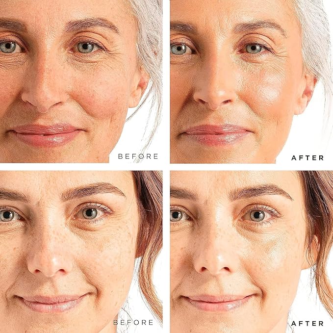 Tree of Life Beauty Facial Skin Care Set, Brightening, Firming, Hydrating, Dry Face, Dermatologist Tested - Retinol Serum and Hydrating Hyaluronic Acid - Skin Care Kit, 2 count of 1 Fl Oz