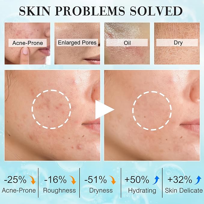 Teen Women Gifts,Skin Care,Skincare,Hydrate,Oil Control,Pore Shrinking,Anti-Allergy Facial Skin Care Routine Kit Travel Size Gift Set Stocking Stuffers for Teen Girls 10-12 16-18 & Women for All Skin