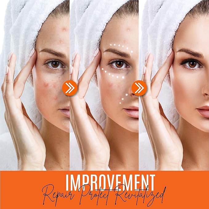 30% Vitamin C Serum for Face - Natural & Organic Anti Wrinkle & Skin Rejuvenator Moisturizer with Hyaluronic Acid & Vitamin E - Powerful Anti Aging Serum - Age-Defying Beauty Regimen- 1FL OZ