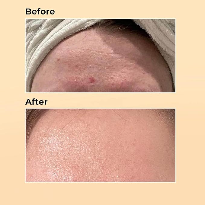 Snail Mucin Serum Luxury Korean 96% Snail Facial Serum Filtrate for skincare, Hydrating Serum For Dry Dull Face Skin and Wrinkles Power Repairing Essence For Face - GoldSnailRX