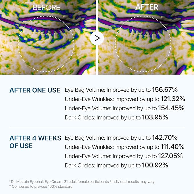 Eyephalt Eyebag Cream for Puffiness, Dark Circles & Fine Lines, Wrinkle, EGF Anti-Aging Under Eye Moisturizer with Niacinamide&Ceramide 0.33 fl.oz.