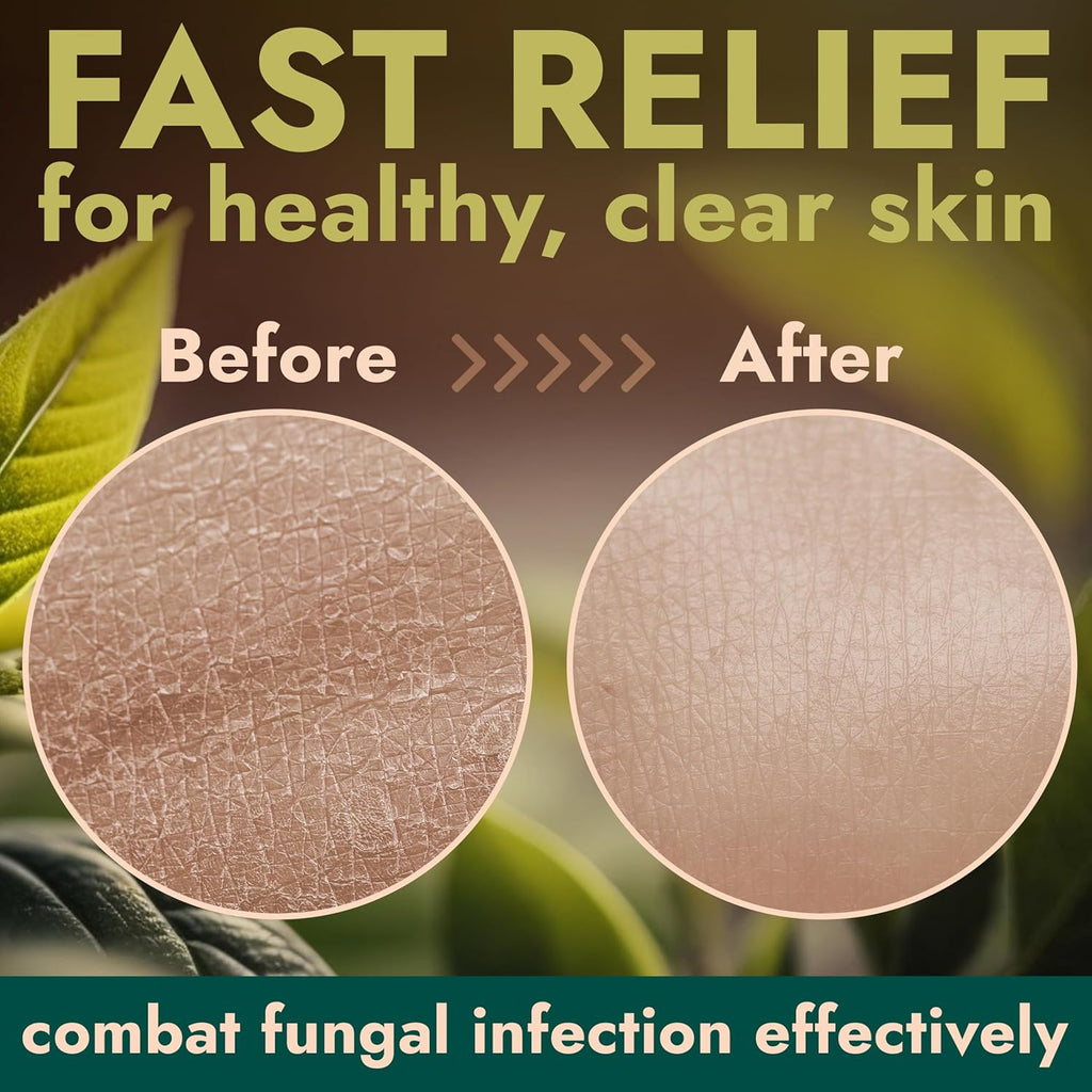 Terramed Just Think Comfort Antifungal & Antibacterial Soap & Body Wash with Tea Tree Oil | Treats Ringworm, Back Acne, Eczema & Jock Itch | Antibacterial Body Soap For Men And Women (16.9 oz)