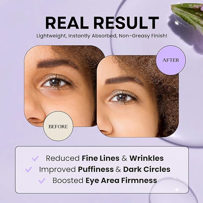 Excuse My Frank Bakuchiol Age Defense Eyecream, Korean Eye Cream, Gentle Cream, Natural Retinol, Dark Circles Puffiness & Firming, Anti Aging, Wrinkle Care, Fragrance Free, Vegan1.01fl oz