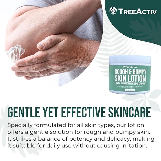 TreeActiv Rough and Bumpy Skin Lotion, 8 fl oz, With Hyaluronic Acid, Shea Butter and Vitamin E, Nourishing Lotion for Rough and Bumpy Skin, Moisturizing Strawberry Legs Treatment, For All Skin Types