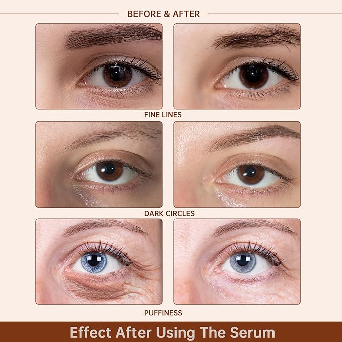 Caffeine Solution 5% + EGCG Eye Serum for Skin Care Caffeine Eye Serum Reducing Puffiness and Dark Circles 30ml