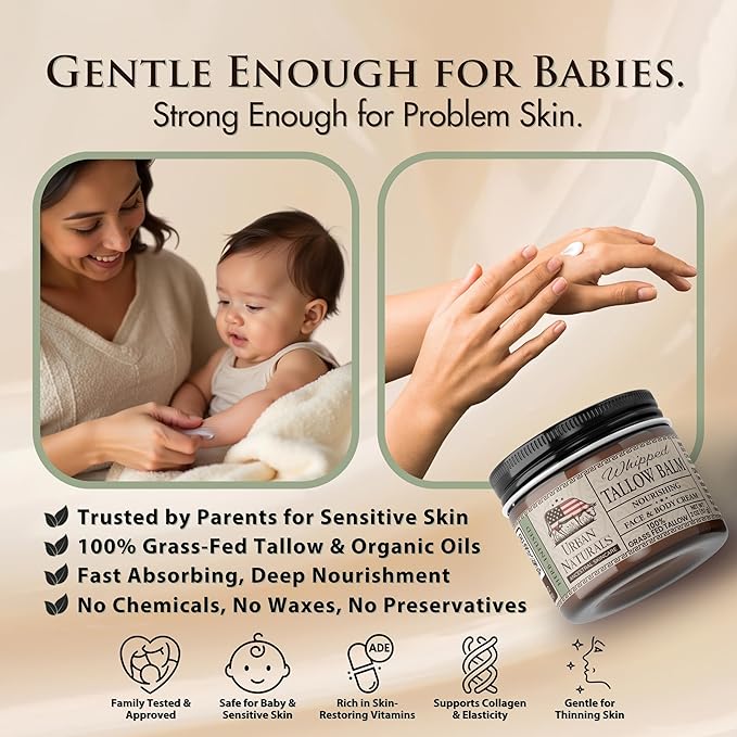 Urban Naturals Handmade Whipped Tallow Balm (Unscented/Herb-Infused) - 100% Grass-fed Organic Body Butter with Infused Jojoba Oil, for Eczema, Rosacea, Baby - 2 oz