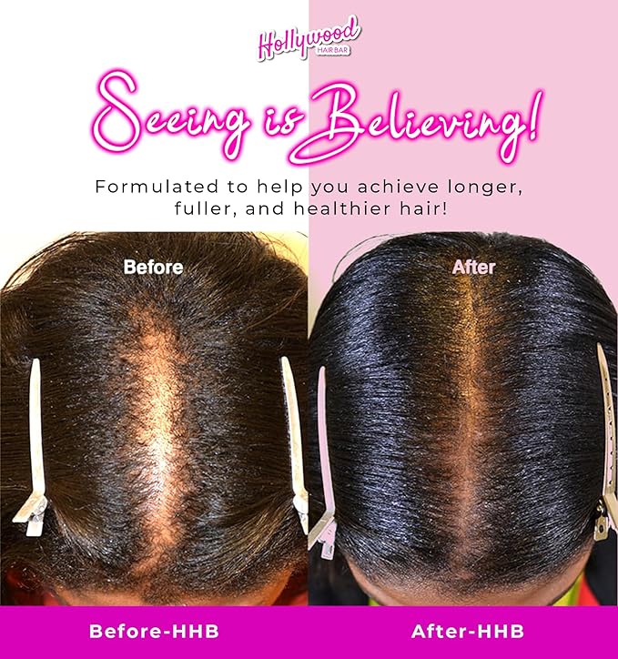 Hollywood Hair Bar | Hair Oil Regrowth Serum - Extra-Strength, Made with All-Natural Essential Oils (Squeeze Bottle) 2 oz