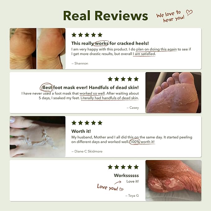 Purederm Shiny & Soft Foot Peeling Mask (3 pack) - For smooth and moist baby skin with Exfoliating peel off Calluses, Dry Skin, Cracked Heels - Men and Women