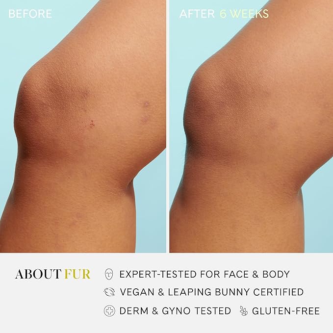 Fur Silk Scrub: Premium KP Bump Eraser - Powerful Exfoliating & Resurfacing Scrub to Smooth and Hydrate Skin While Preventing Ingrown Hairs with Natural Oils and AHAs - 6 Fl oz.