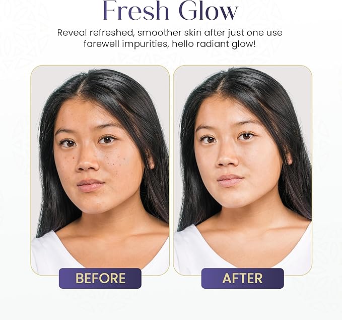 Glycolic Acid Toner Ordinary Glycolic Solution for Face Hydrating and Skin Toner for Women Face with AHA, Aloe Vera, Extract Facial Toner for Brightening, Acne, Exfoliation, and Skin Care 6.4 oz