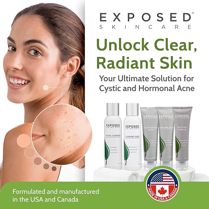 Exposed Skin Care Expanded Acne Treatment Kit - Includes Salicylic Acid Face Wash, Clearing Tonic, Treatment Serum with Benzoyl Peroxide, Clear Pore Serum, Moisture Complex - Made for All Skin Types