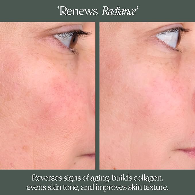 Doctor Rogers Night Repair Treatment REFILL. Restoring & Hydrating Anti-Aging Face Serum with Glycolic Acid, 1 Ounce (30 ml)